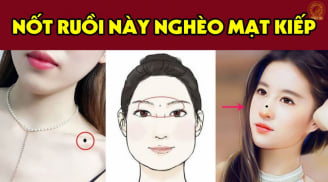 5 nốt ruồi cả trở tài lộc, nên tìm cách hóa giải