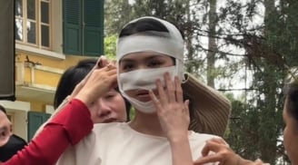 Hình ảnh Ngọc Trinh băng bó kín cả mặt gây hoang mang