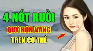 4 nốt ruồi mang tới may mắn đừng dại xóa đi