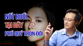 3 nốt ruồi may mắn giàu sang trọn đời