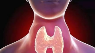 Không được ăn thịt gà khi mắc bệnh tuyến giáp? Cảnh báo 4 nhóm thực phẩm dễ gây dị ứng cần hạn chế