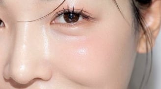 Mỡ lợn có thực sự tốt cho da? Cách dùng đúng để dưỡng ẩm và phục hồi hiệu quả