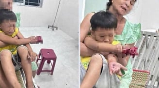 Cháu bé bị dập bàn tay nghi do điện thoại nổ khi đang sạc pin