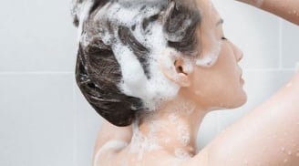 Gội đầu thường xuyên vẫn bong tróc da đầu: 5 công thức tự nhiên giúp giảm gàu rõ rệt