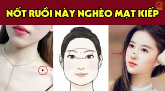 3 nốt ruồi lận đận nên tìm cách hóa giải kẻo về già cô độc