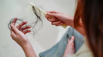 4 thực phẩm gây rụng tóc, ăn càng nhiều tóc càng mỏng