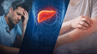5 dấu hiệu cơ thể tưởng bình thường nhưng có thể K đã tấn công