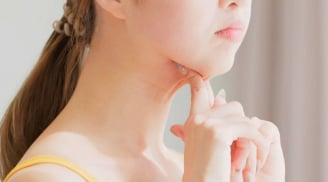 Mẹo ăn uống giúp giảm béo mặt, giảm nọng cằm