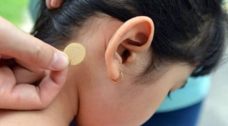 Bé gái 7 tuổi bị rối loạn hành vi, nói nhảm suốt đêm vì tác dụng phụ của miếng dán chống say tàu xe