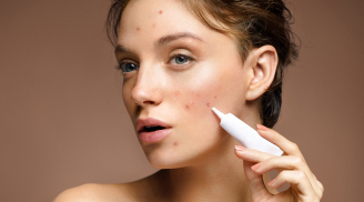 6 cách giúp làm mờ thâm sau mụn và phục hồi làn da sáng khỏe hiệu quả hơn