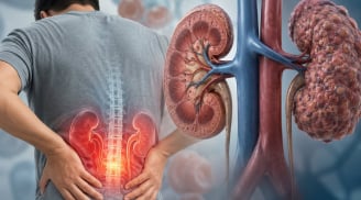 4 loại đồ uống làm tăng gánh nặng cho thận, nhiều người Việt vẫn dùng thường xuyên
