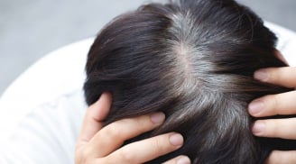 Tóc bạc sớm ở 3 vị trí này có thể là dấu hiệu gan, thận suy yếu
