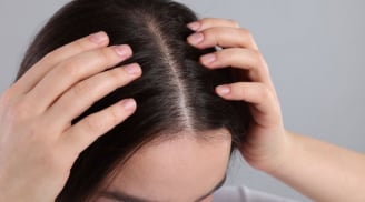Nguyên nhân gội đầu xong vẫn nhiều gàu và ngứa