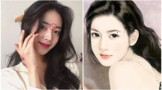 3 nốt ruồi trên mặt mang tới may mắn: Đừng dại xóa đi