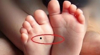 4 nốt ruồi trên chân mang tới may mắn cho bạn: Ai có thật đáng chúc mừng