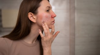 4 thói quen tưởng vô hại trong ngày nắng nóng nhưng có thể khiến làn da xuống cấp nhanh chóng