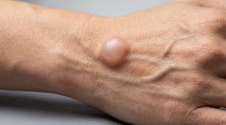 Cảnh báo: 4 thay đổi bất thường ở cánh tay có thể là 'tín hiệu cầu cứu' của cơ thể trước bệnh ung thư