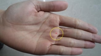 4 nốt ruồi trên bàn tay mang tới may mắn cho bạn: Ai có thật đáng chúc mừng