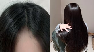 Cách gội đầu bằng vitamin B1 giúp tóc mọc nhanh, dày và chắc khỏe