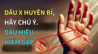 3 dấu hiệu trên lòng bàn tay của người tài ba, may mắn