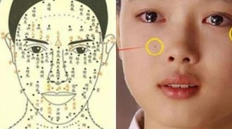 3 nốt ruồi hao tài khánh kiệt nên hóa giải