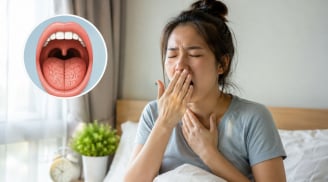 Ngủ dậy thấy khô miệng hãy chú ý điều này