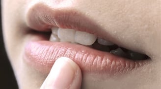 4 thói quen khiến môi ngày càng thâm sạm, nhiều người mắc phải mà không hay biết