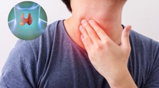 5 dấu hiệu u tuyến giáp đang âm thầm phát triển, nhiều người bỏ qua