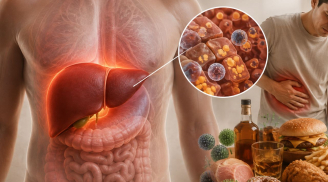 Những dấu hiệu này thì đừng chủ quan: Gan đang 'kêu cứu' nhưng nhiều người bỏ qua