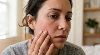 Thận suy yếu có thể biểu hiện trên mặt: 5 thay đổi nhiều người dễ bỏ qua