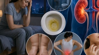Những dấu hiệu xuất hiện vào buổi tối có thể cảnh báo vấn đề ở thận nhưng nhiều người vẫn bỏ qua