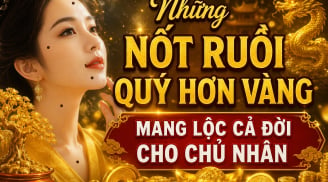 Những nốt ruồi quý hơn vàng mang lộc cả đời cho chủ nhân