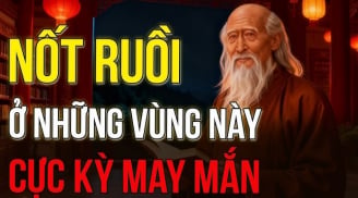 3 nốt ruồi Quý nhân phù trợ, đừng dại tẩy đi