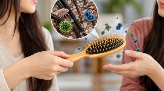 Vì sao không nên cho mượn lược chải tóc?