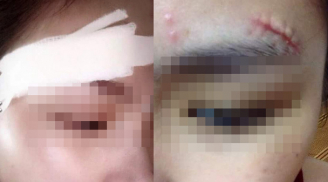 Phẫn nộ: Nghi vấn bạn trai đá rách mặt người yêu cũ