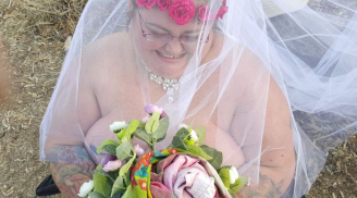 Kỳ lạ: Cô gái bị bệnh vi khuẩn ăn thịt người tỉnh dậy làm đám cưới 'nude'