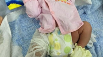 Vụ làm gãy xương đùi trẻ sơ sinh sau khi mổ đẻ: Bệnh viện chính thức lên tiếng