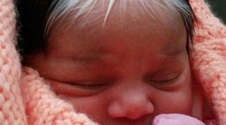 Kỳ lạ: Em bé sinh ra có 2 màu tóc, 2 màu da và vết bớt trắng đặc biệt