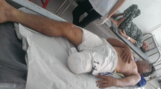 Sốc: Nhân viên y tế nghi tự cắt lìa chân, giấu vào tủ rồi hô hoán bị người lạ 'cắt trộm'