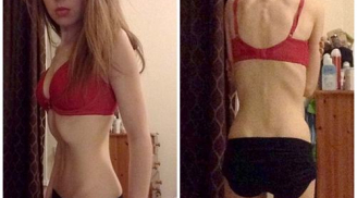 Cô gái 'xương khô' chỉ nặng 25,5kg bất ngờ sở hữu thân hình 'chuẩn như người mẫu'