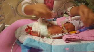 Ông bố Việt nhờ cộng đồng giúp đỡ 4 tỷ cứu con sinh non tại Singapore: Không thể chuyển cháu bé về Việt Nam?