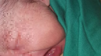 Vừa chào đời bé gái đã có 2 chiếc răng cửa khiến bác sĩ và gia đình kinh ngạc