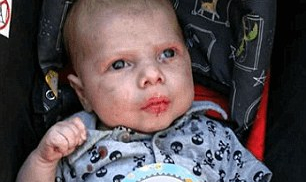 Phẫn nộ: Bé trai 9 tuần tuổi bị bố đẻ đánh đập gãy xương, chảy máu trong não ch.ết thương tâm
