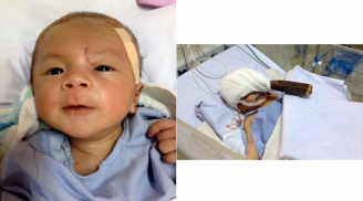 Hình ảnh mới nhất và tình hình sức khỏe khi tròn 17 tháng tuổi của bé trai bị dao dâm xuyên não