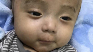 Nước mắt đau thương của hàng nghìn người khi nghe tin đã hết cách cứu chữa em bé bị mắc bệnh não úng thủy
