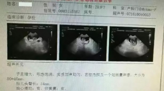 Bé gái Việt Nam 12 tuổi mang thai tại Trung Quốc: Hé lộ có đường dây buôn người đứng sau sự việc