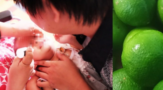 Cháu bé 15 ngày tuổi bị loét giác mạc nghiêm trọng vì sai lầm lớn của người bà