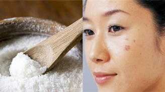 2 công thức trị thâm cực nhanh chỉ bằng cách sử dụng muối