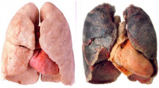 Thực phẩm giúp lọc sạch phổi cho người hút thuốc lá