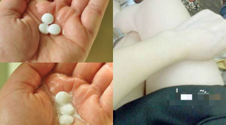 Nghiền vitamin B1 trộn với thứ này da trắng chỉ trong 2 ngày